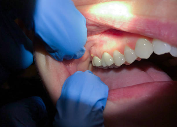  Kelly Ridge, CA Emergency Dentist Pros