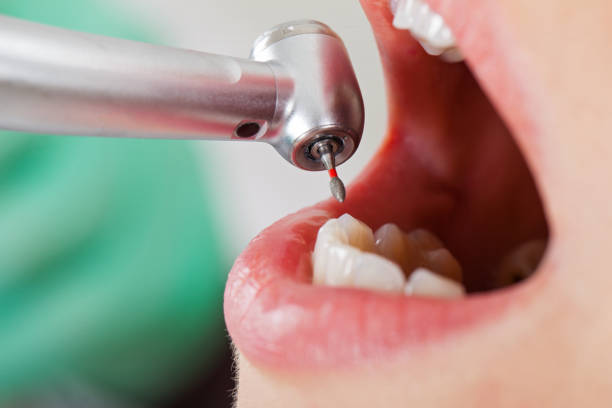 Best Cosmetic Emergency Dentistry in Kelly Ridge, CA